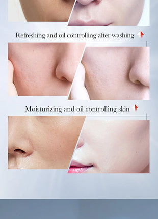 Kojic Acid Facial Wash - Deep Cleansing, Oil-Control, Moisturizing, Non-Irritating Face Cleanser (100g)