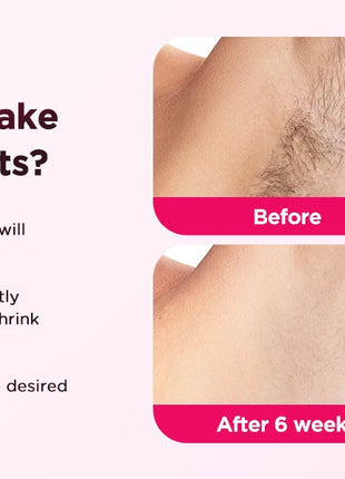 IPL Laser Hair Removal Device for Men & Women - Painless Permanent Epilator