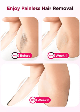 IPL Laser Hair Removal Device for Men & Women - Painless Permanent Epilator